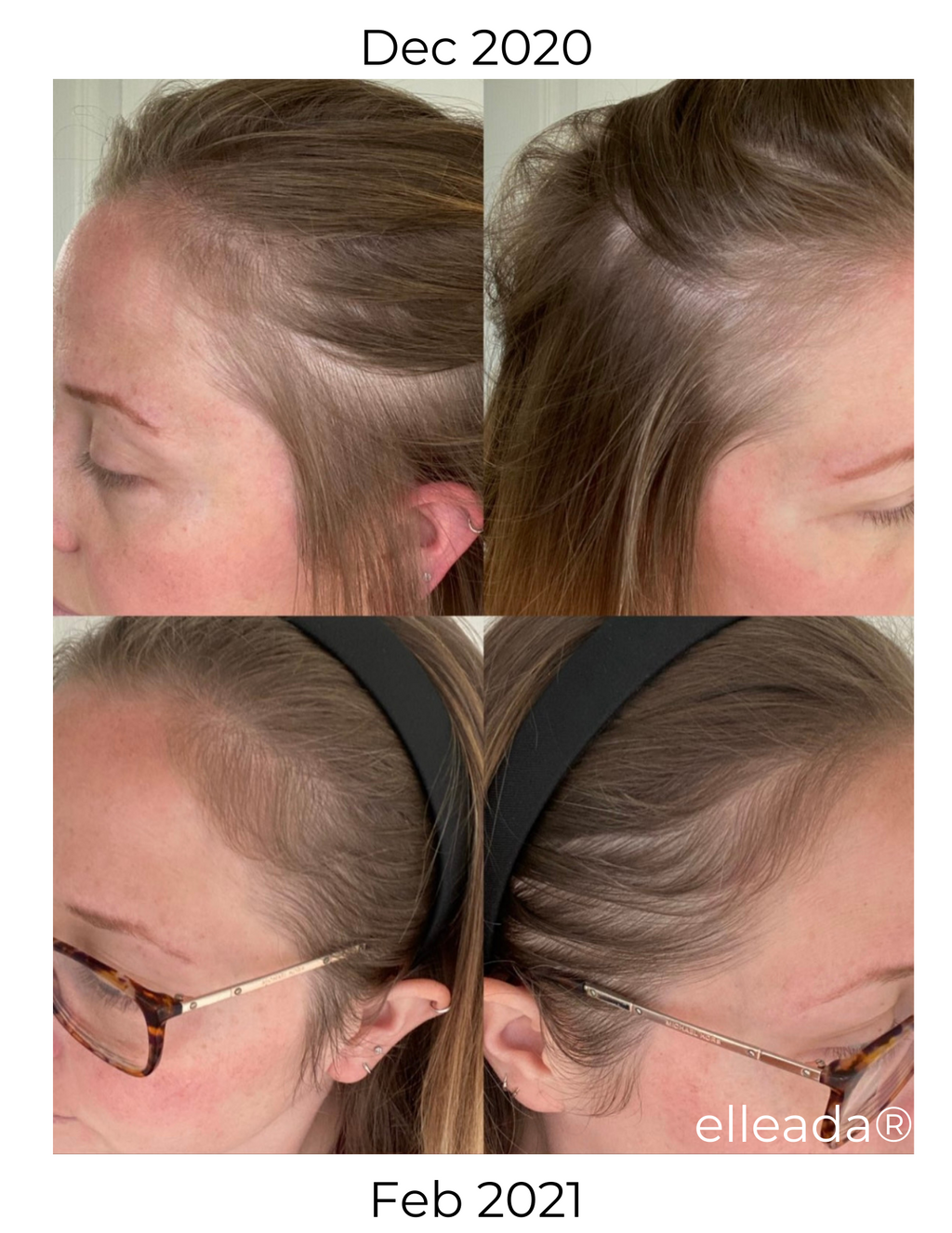 Elleada Botanical Scalp & Hair Serum