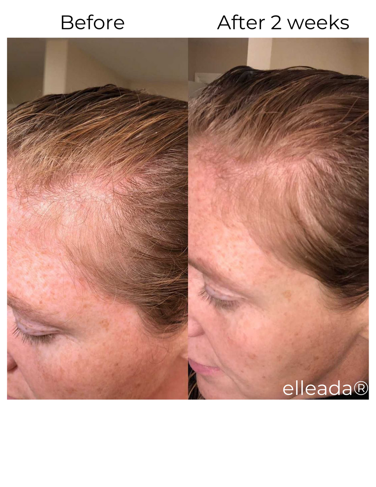 Elleada Botanical Scalp & Hair Serum