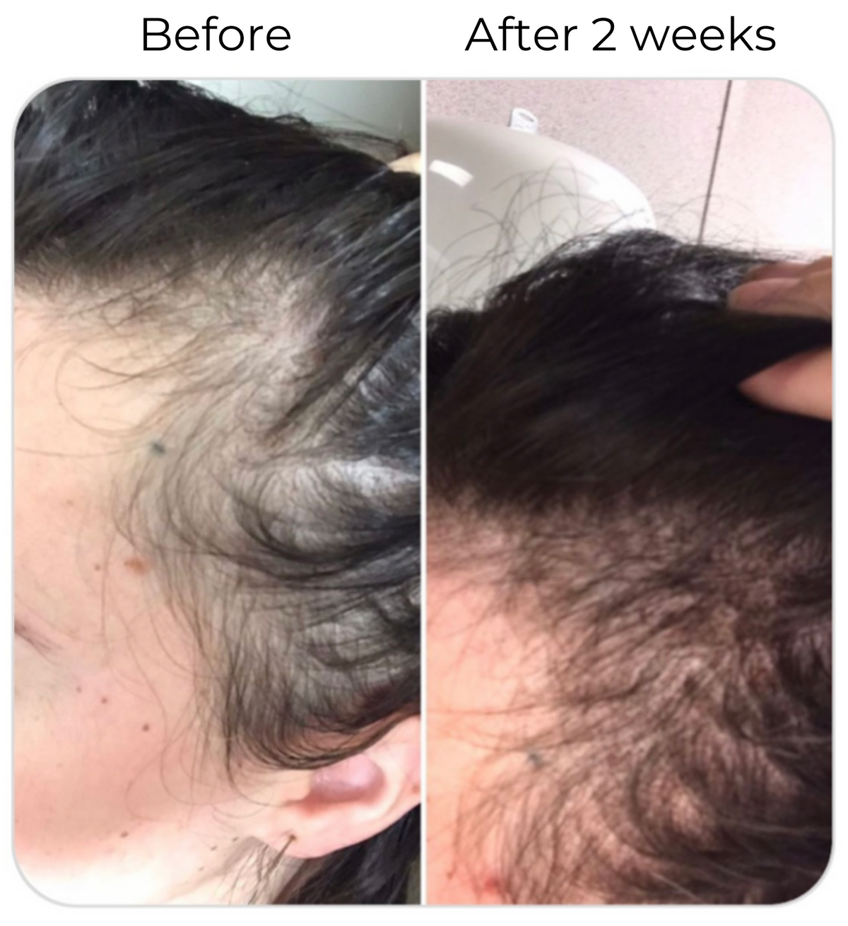 Elleada Botanical Scalp & Hair Serum