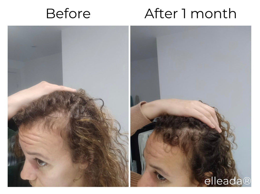 Elleada Botanical Scalp & Hair Serum