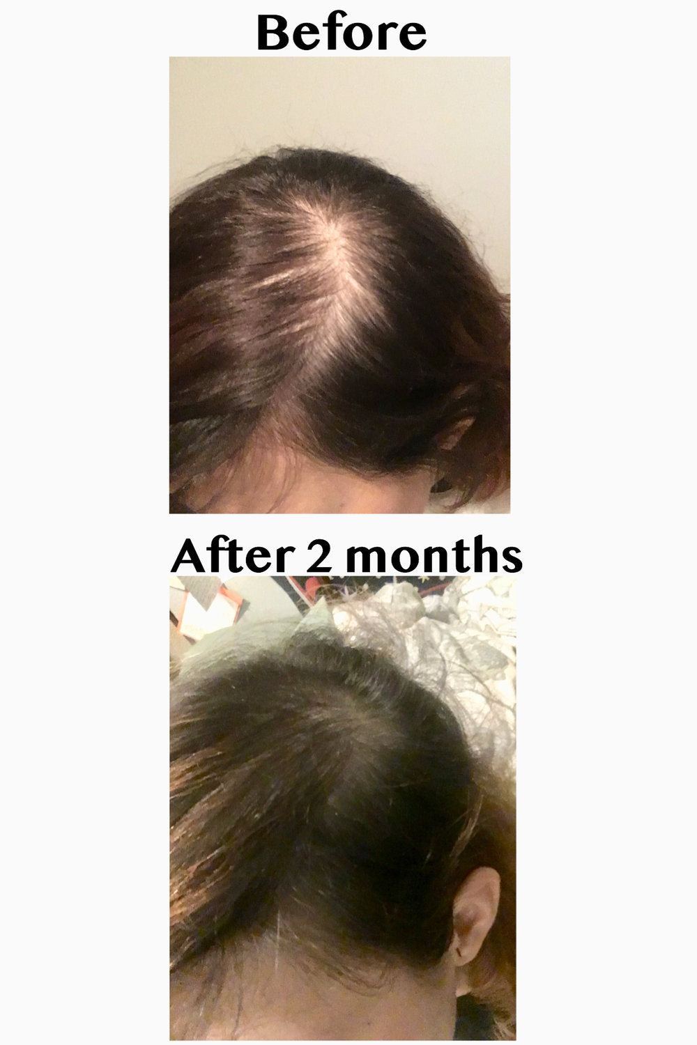 Elleada Botanical Scalp & Hair Serum