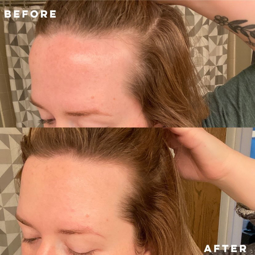 Elleada Botanical Scalp & Hair Serum