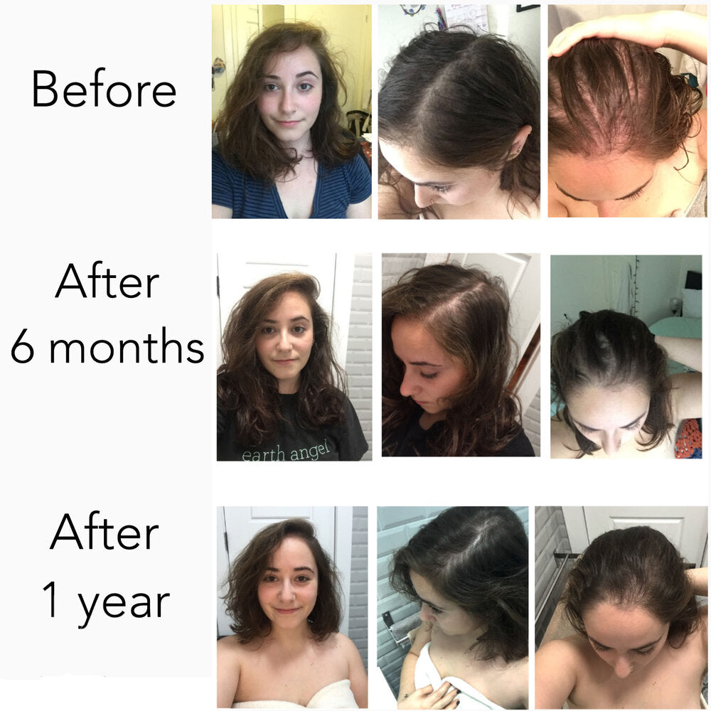 Elleada Botanical Scalp & Hair Serum