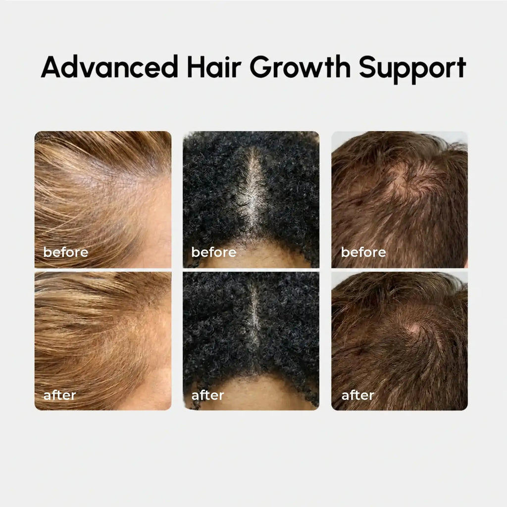 Marée 4-in-1 Rosemary Scalp Spray