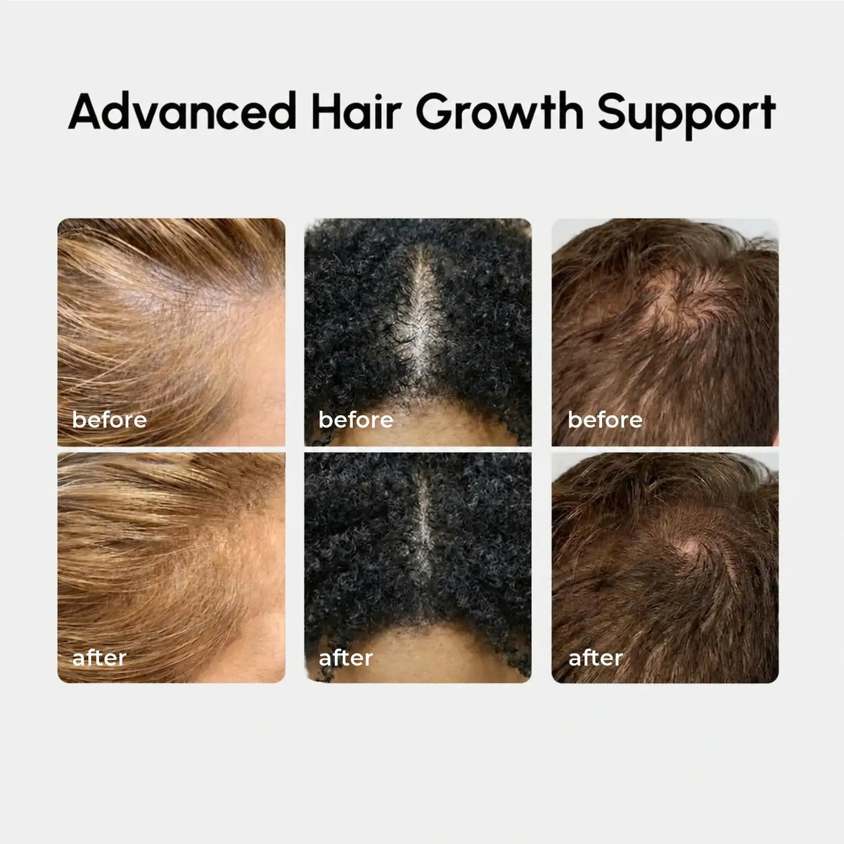 Marée 4-in-1 Rosemary Scalp Spray