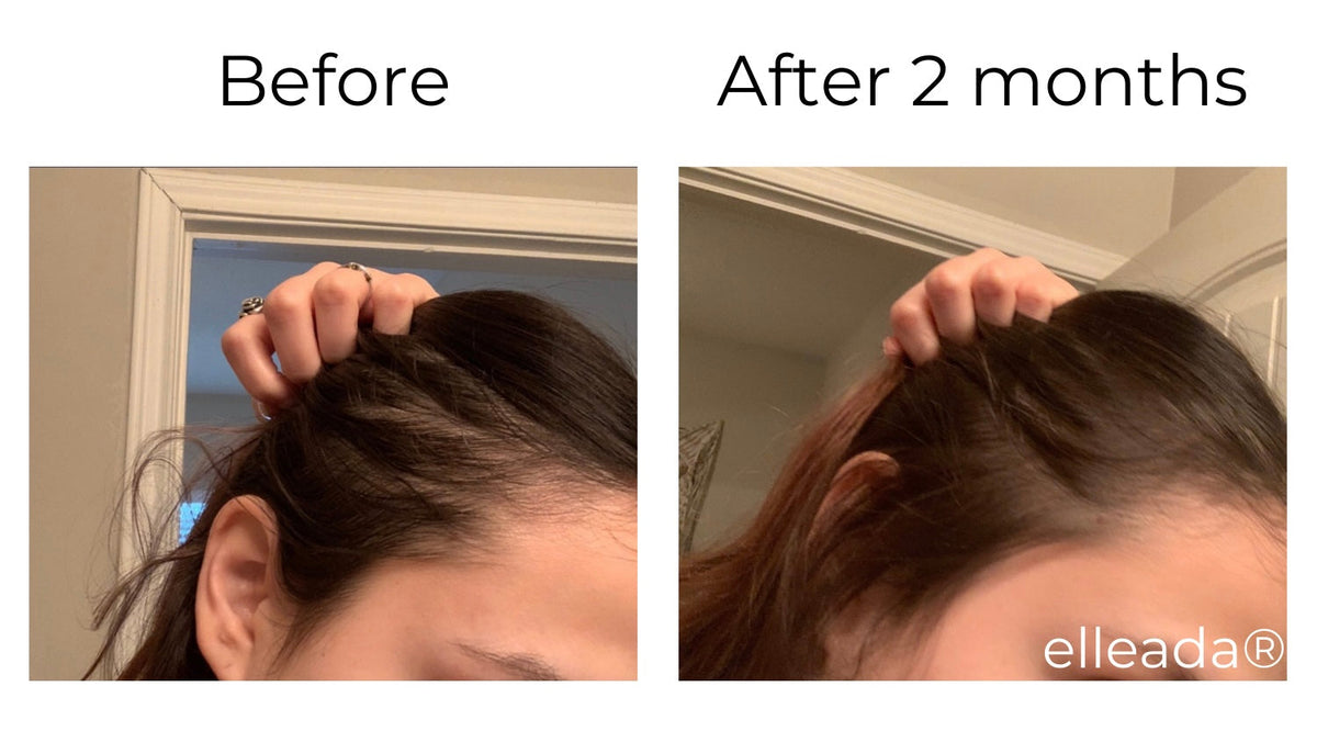 Elleada Botanical Scalp & Hair Serum