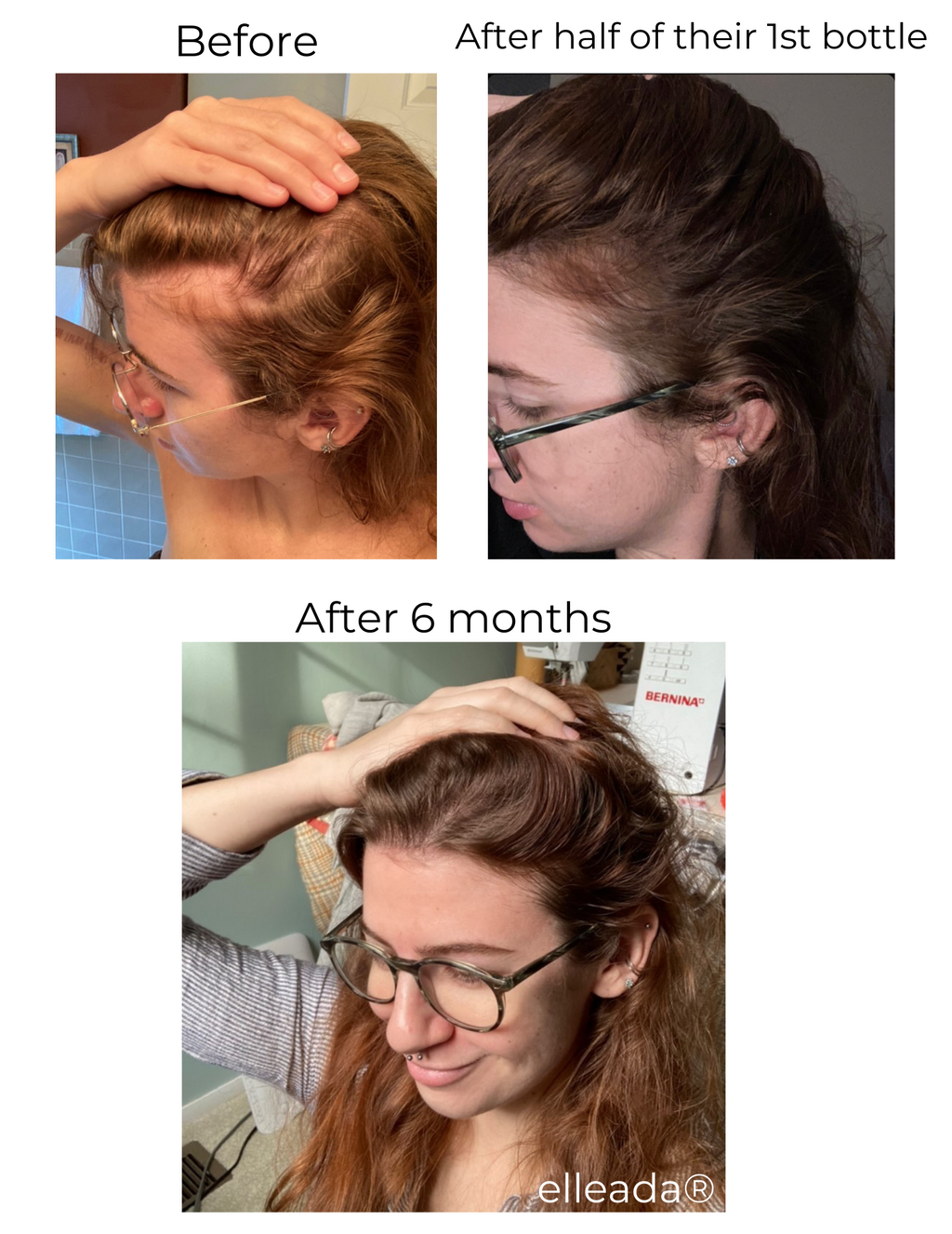 Elleada Botanical Scalp & Hair Serum