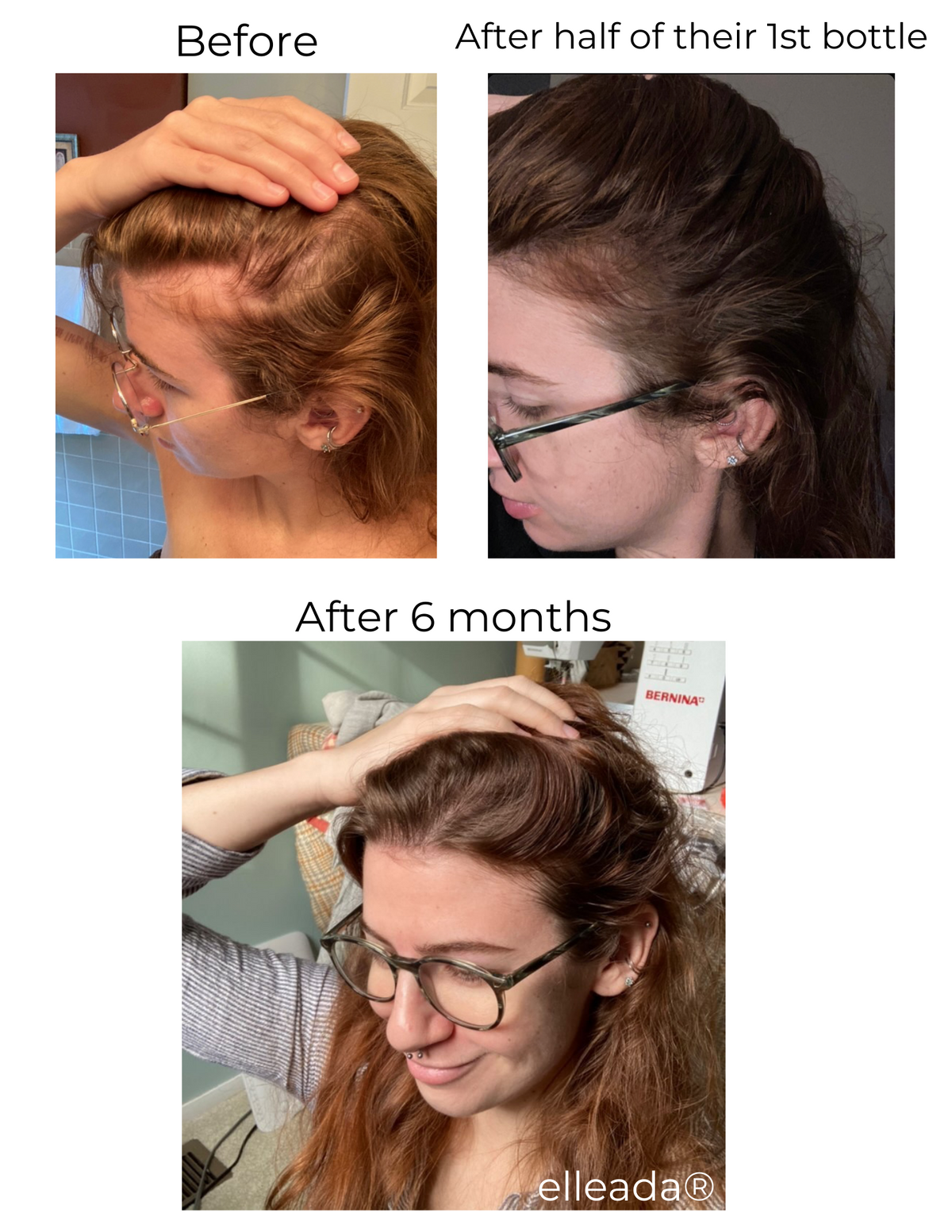Elleada Botanical Scalp & Hair Serum