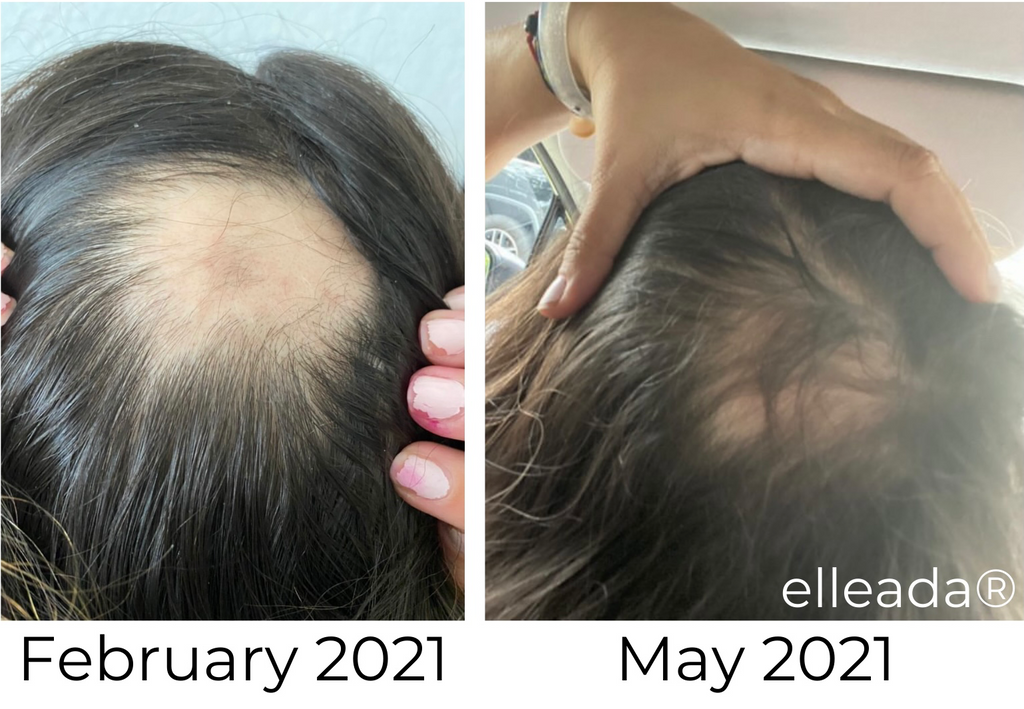 Elleada Botanical Scalp & Hair Serum