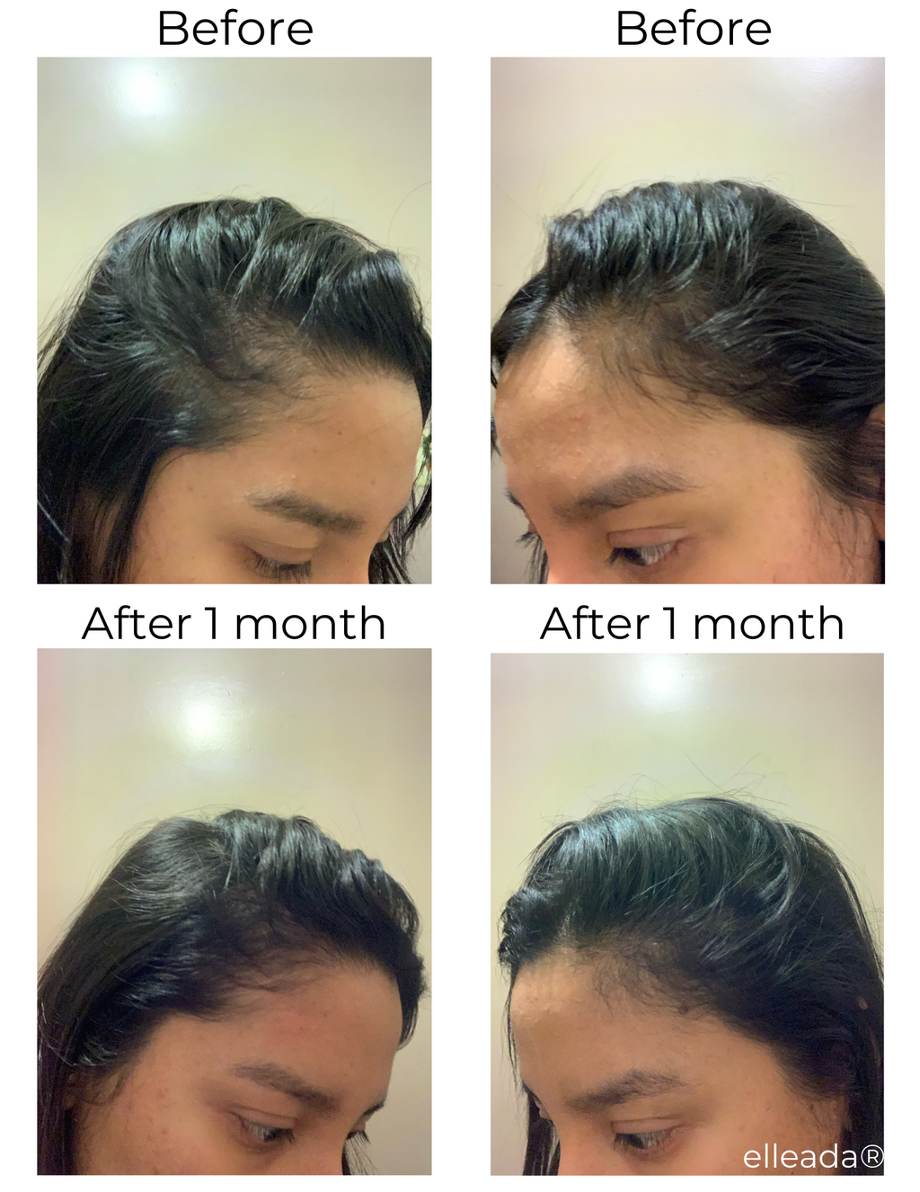 Elleada Botanical Scalp & Hair Serum