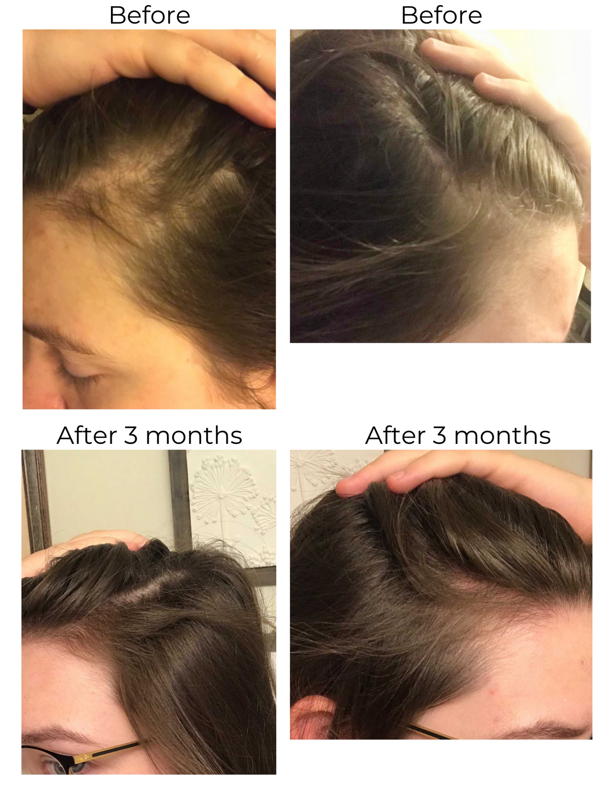 Elleada Botanical Scalp & Hair Serum