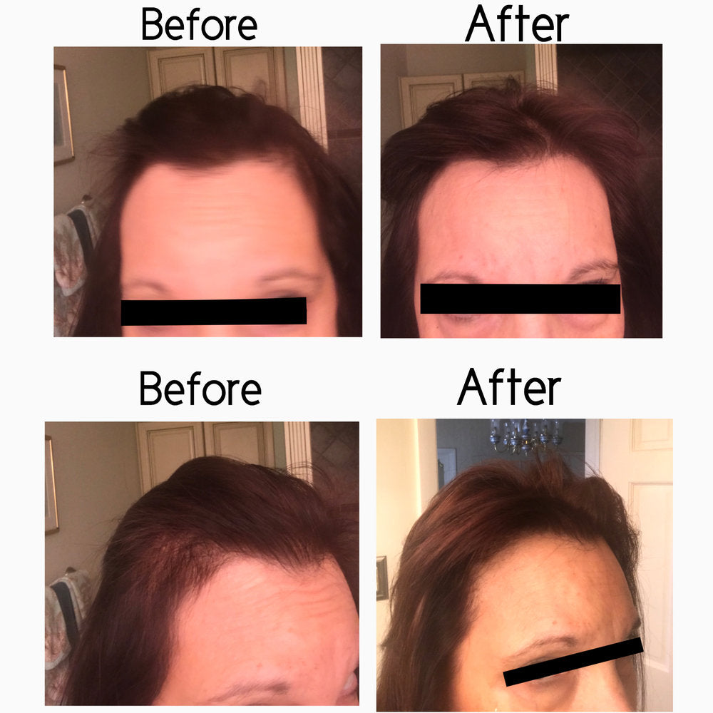 Elleada Botanical Scalp & Hair Serum