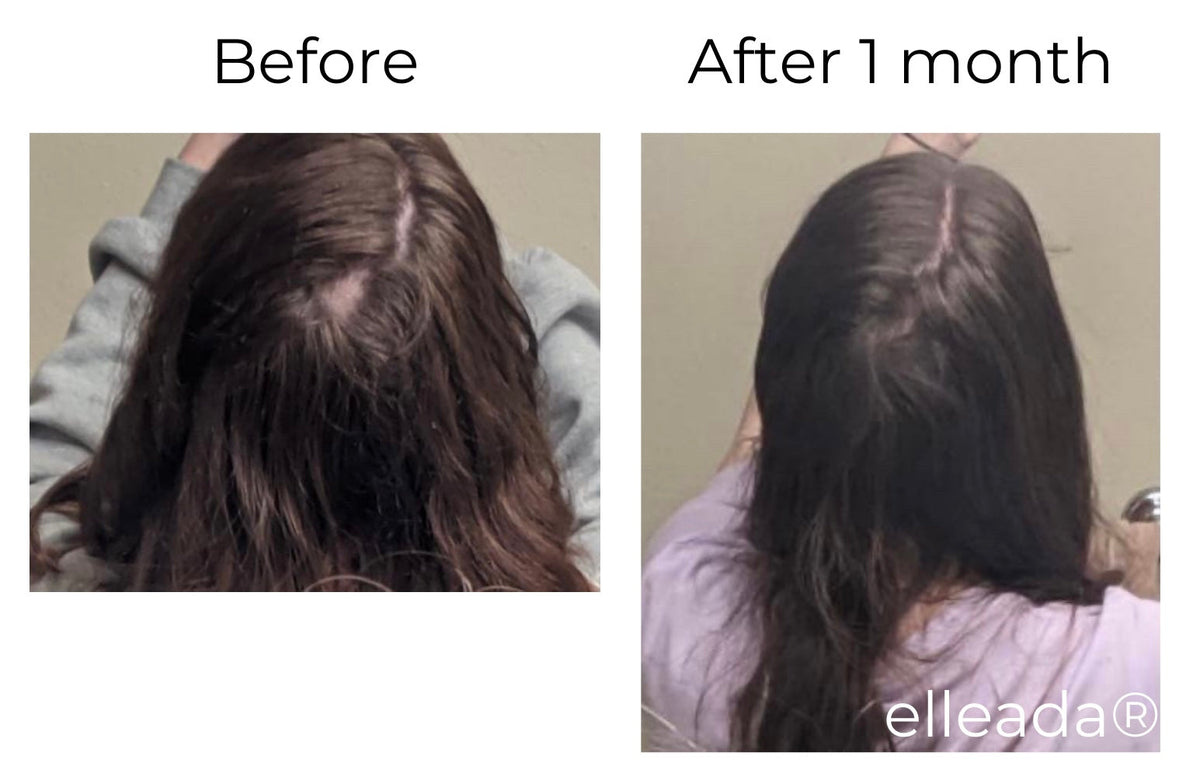 Elleada Botanical Scalp & Hair Serum